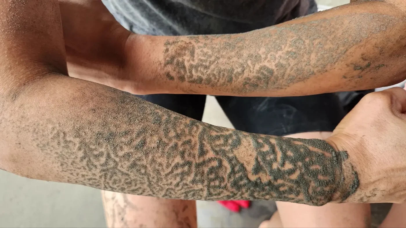 Close-up of dried mud forming branching patterns on two forearms